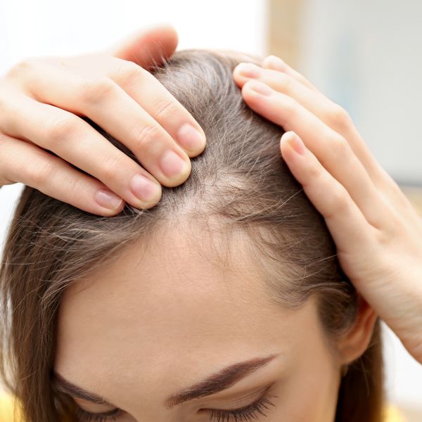 Les bienfaits de l'huile de Nigelle contre la chute de cheveux