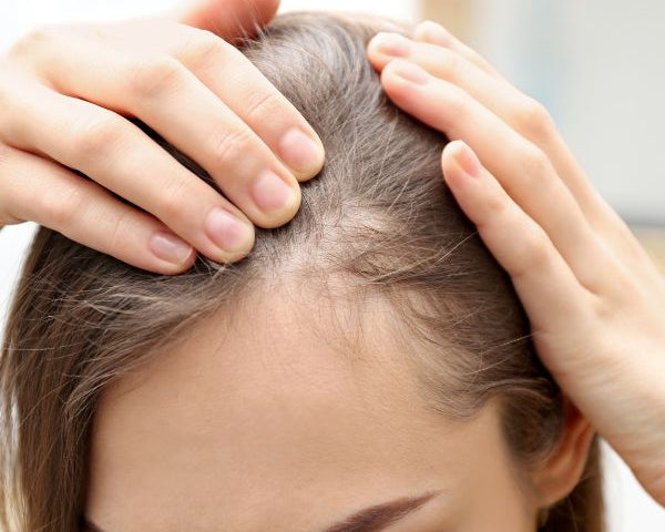 Les bienfaits de l'huile de Nigelle contre la chute de cheveux